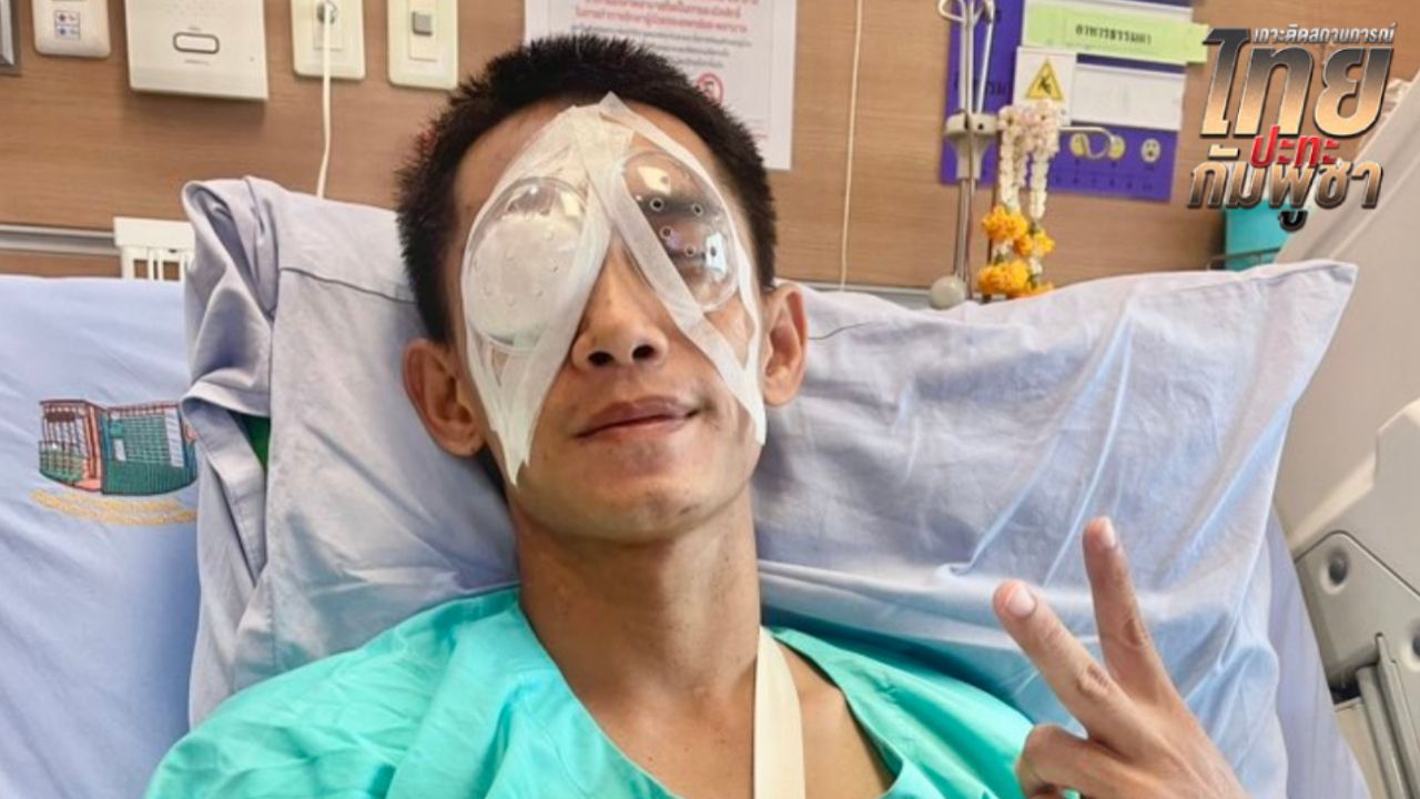 'สิบเอกสุทธิชัย' นักรบตาควาย ผ่าตัดตารอบ 4 หมอนำสะเก็ดที่ลึกที่สุดออกมาได้ด้วยดี