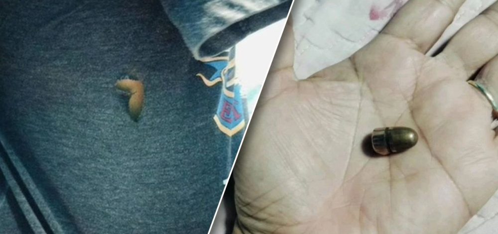 หนุ่มวัย 19 ถูกกระสุนปริศนาพุ่งใส่ลำตัว ทะลุเสื้อขาดเป็นรู แต่มีแผลแค่รอยแดง