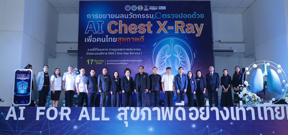 อว. ผนึก สธ. นำนวัตกรรม AI Chest X-Ray ตรวจคัดกรองโรคปอดฟรี เพื่อคนไทยสุขภาพดี